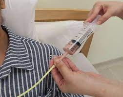 Tube Feeding